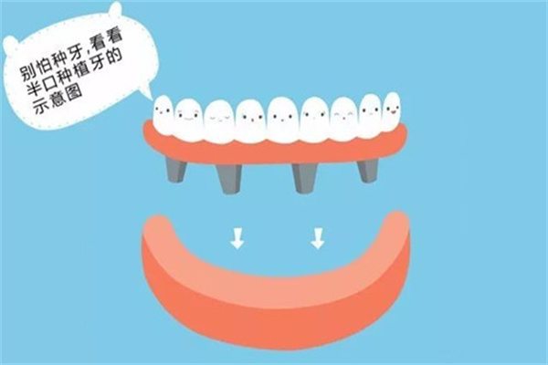 种植牙在国外被淘汰了？真相是并没有！再生牙技术目前只是研究