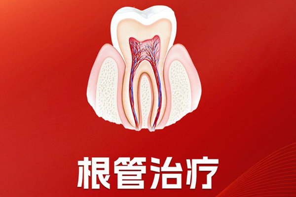 包头根管治疗收费标准：前牙400元起/后磨牙1200元起含显微与再治疗价格明细