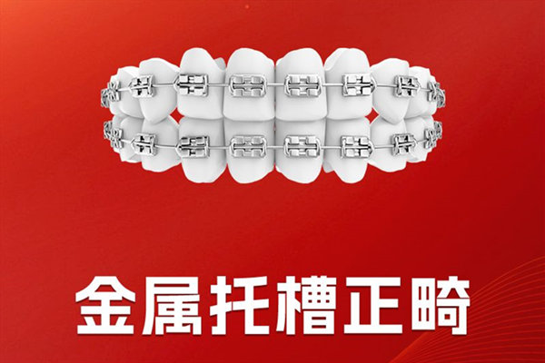 金属托槽牙齿矫正示意图